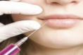 Preenchimento Facial / Lábios