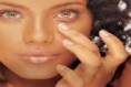 Telangiectasia Facial